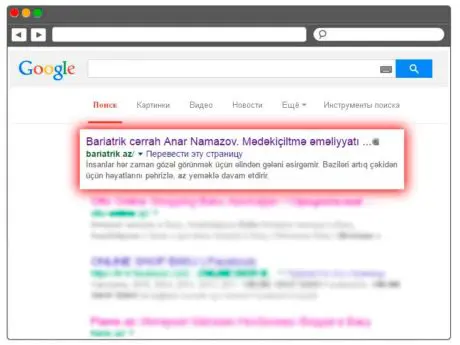 Bariatrik Cərrahiyyə Saytının Google-da Irəlilənməsi